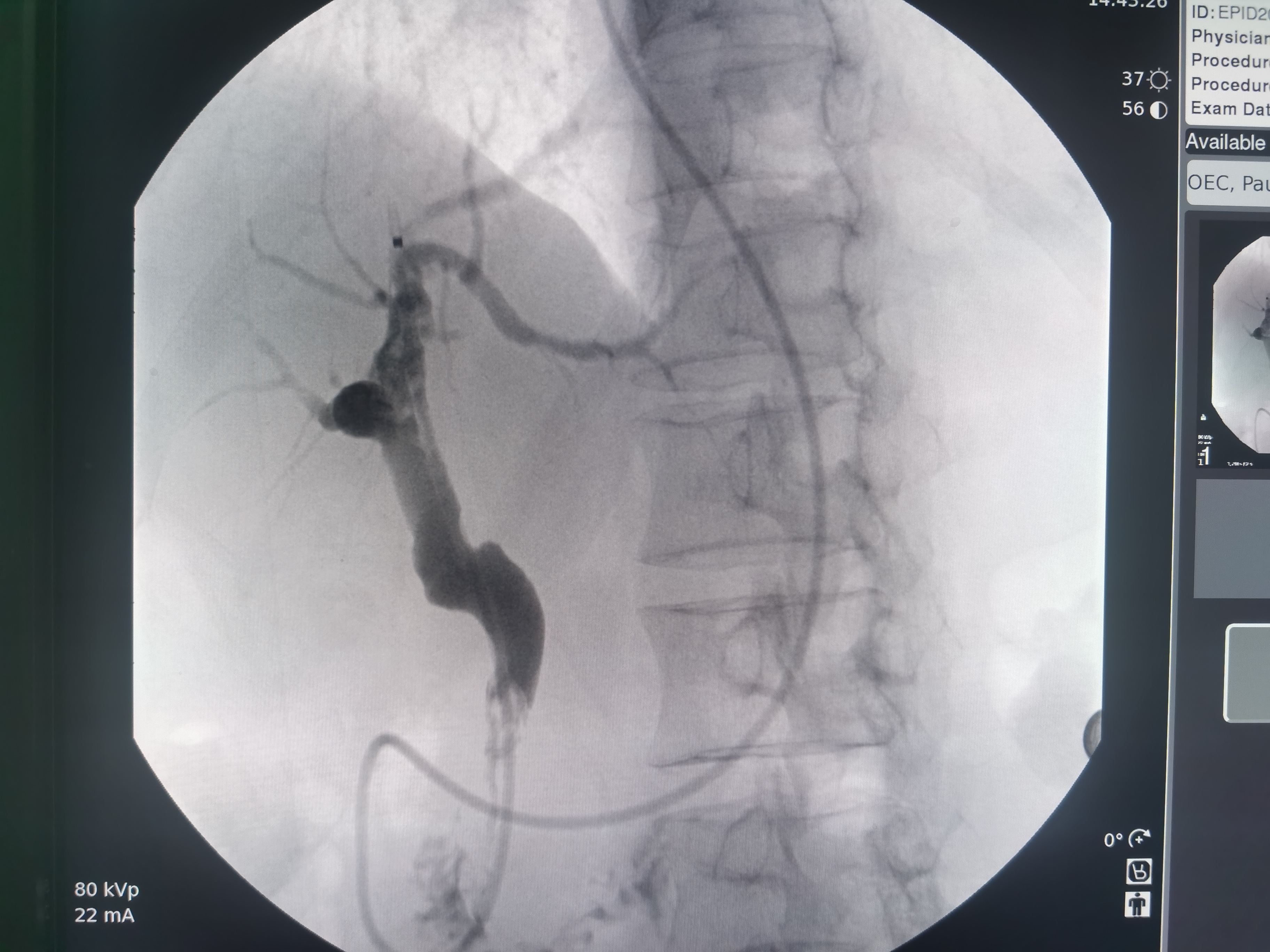 蘭州市排查醫療器械安全風險隱患